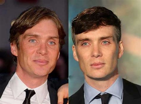 does cillian murphy have plastic surgery